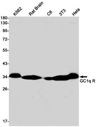 GC1q R Rabbit mAb