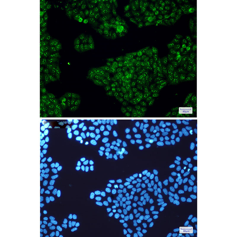 Calretinin Rabbit mAb