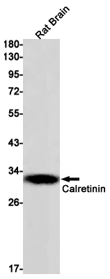 Calretinin Rabbit mAb