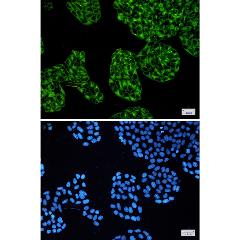 cAMP Protein Kinase Catalytic Subunit Rabbit mAb