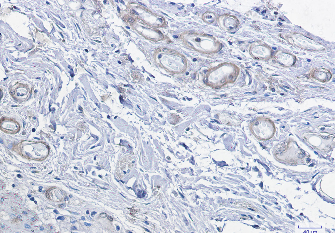 cAMP Protein Kinase Catalytic Subunit Rabbit mAb