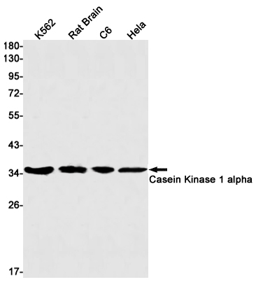 Casein Kinase 1 alpha Rabbit mAb