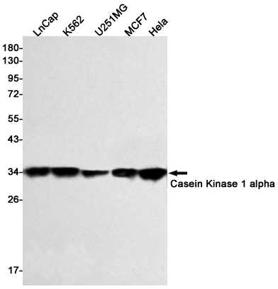 Casein Kinase 1 alpha Rabbit mAb