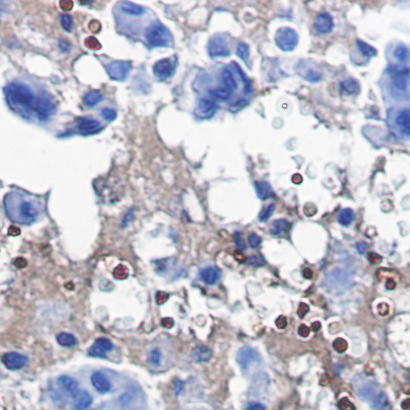 Catalase Rabbit mAb