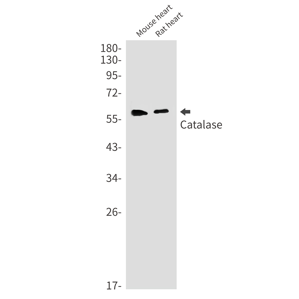 Catalase Rabbit mAb