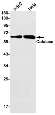 Catalase Rabbit mAb