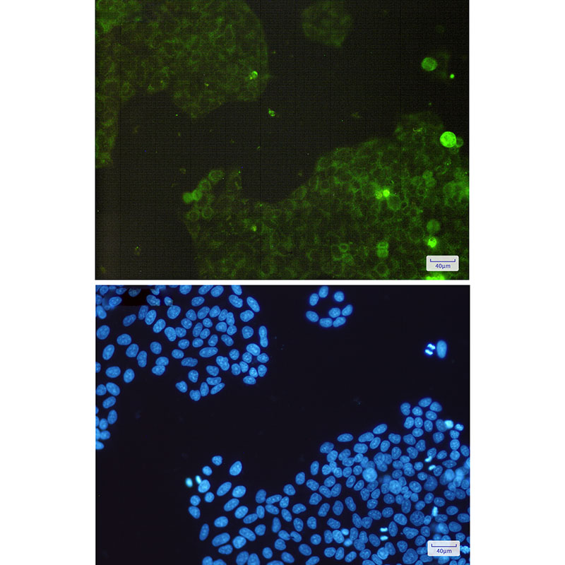 Catalase Rabbit mAb