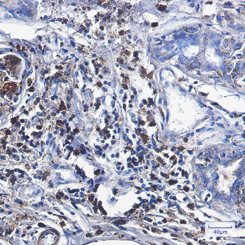 Catalase Rabbit mAb