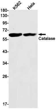 Catalase Rabbit mAb