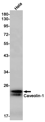 Caveolin 1 Rabbit mAb