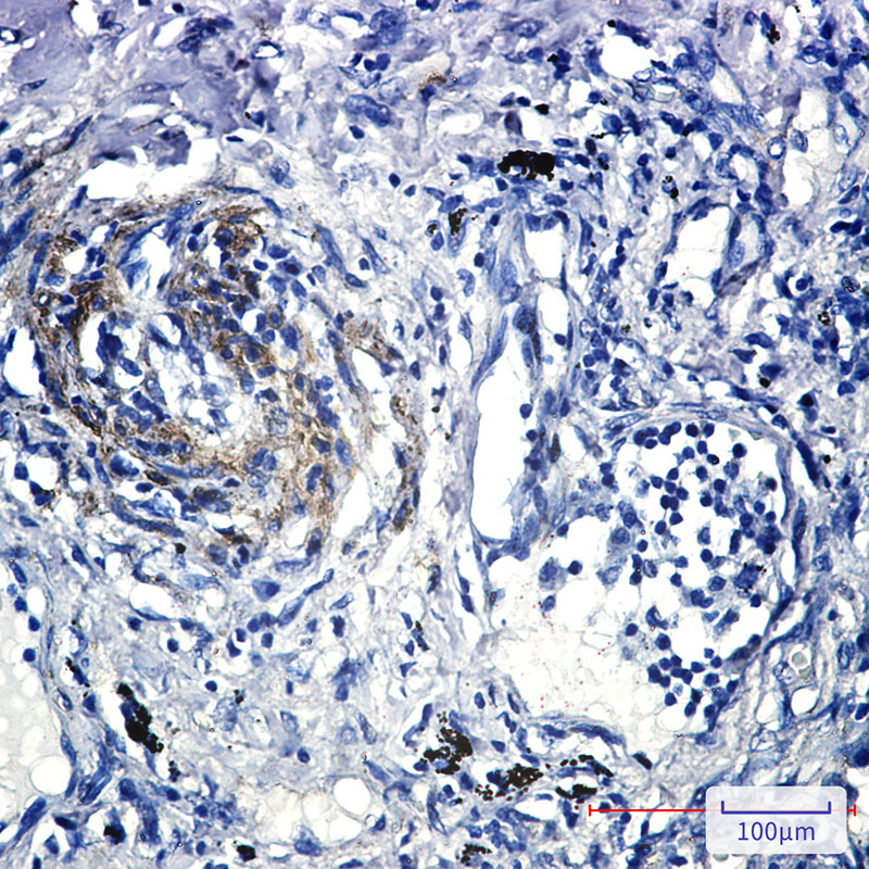 Caveolin 2 Rabbit mAb