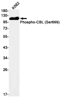 Phospho-CBL (Ser669) Rabbit mAb