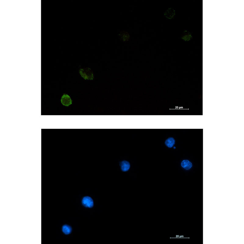 CBL Rabbit mAb