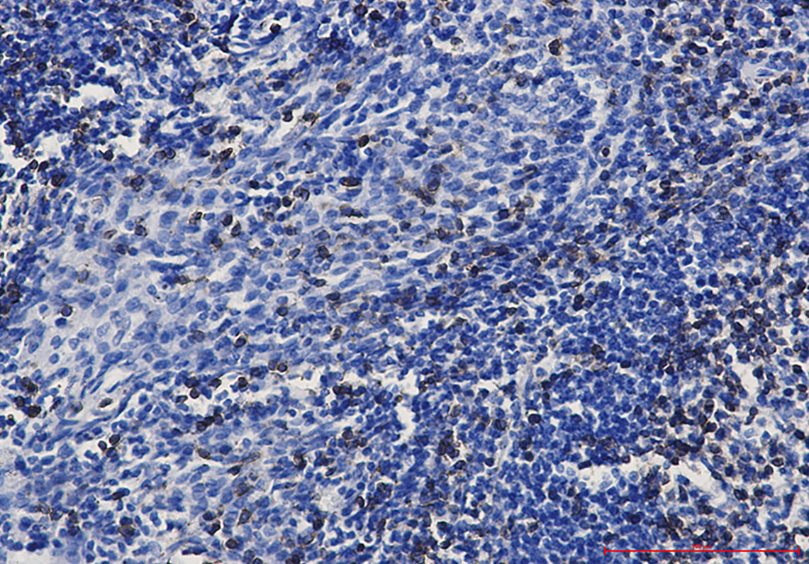 CD3 epsilon Rabbit mAb