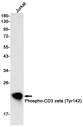 Phospho-CD3 zeta (Tyr142) Rabbit mAb