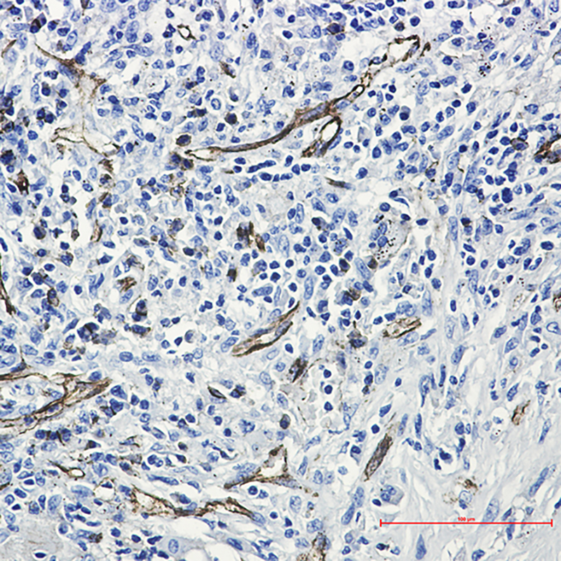 CD31 Rabbit mAb