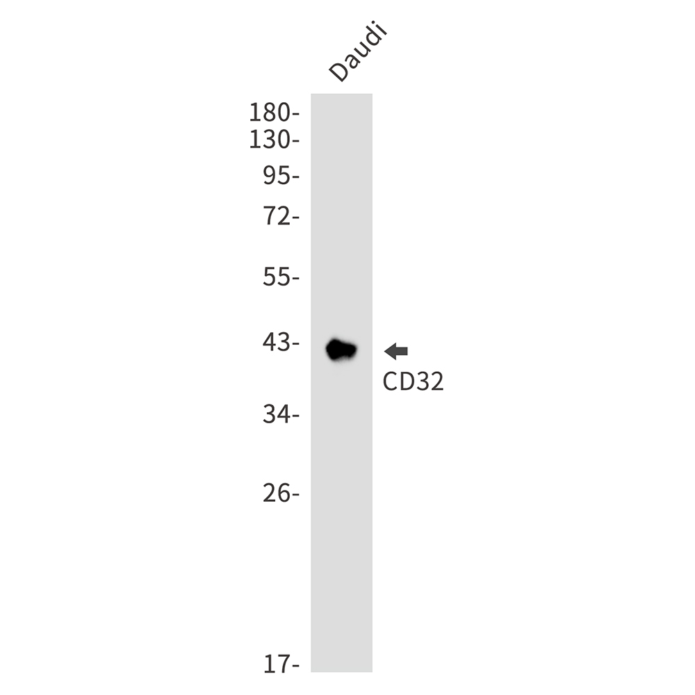 CD32 Rabbit mAb