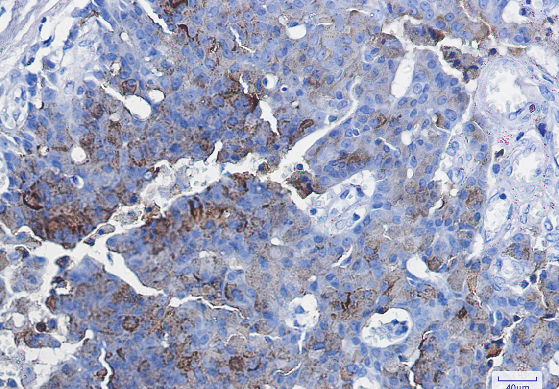 CD63 Rabbit mAb