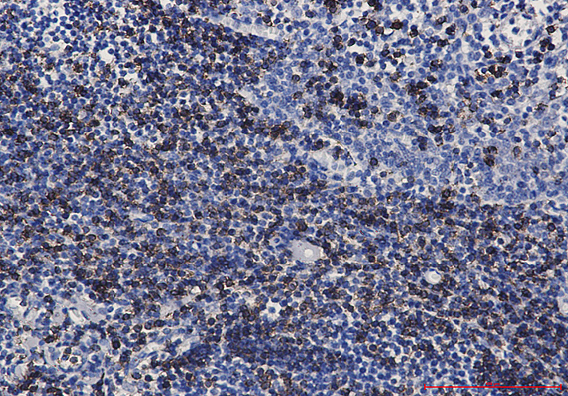 CD7 Rabbit mAb