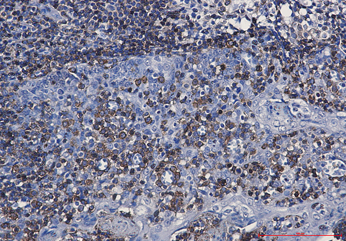 CD79a Rabbit mAb