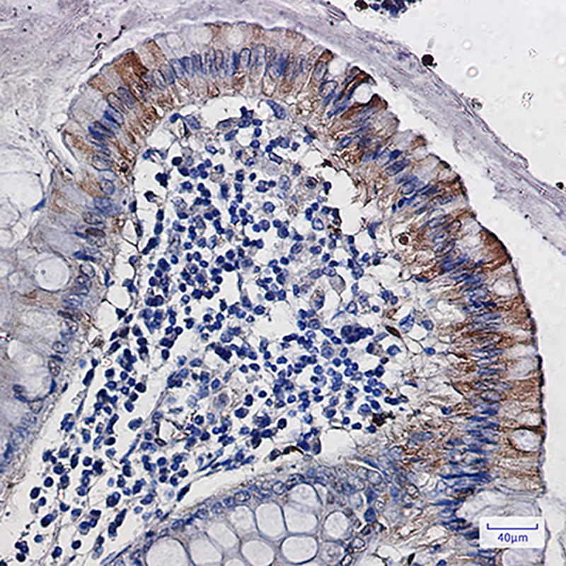 CDA Rabbit mAb