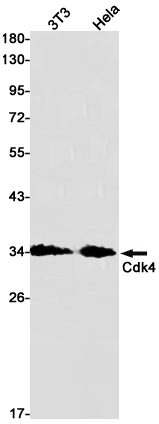 CDK4 Rabbit mAb