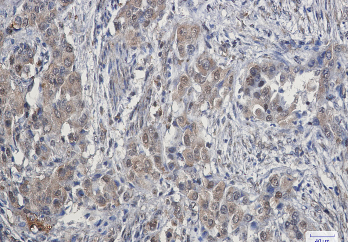 CDK4 Rabbit mAb