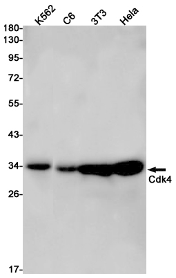 CDK4 Rabbit mAb