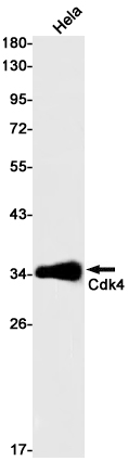 CDK4 Rabbit mAb