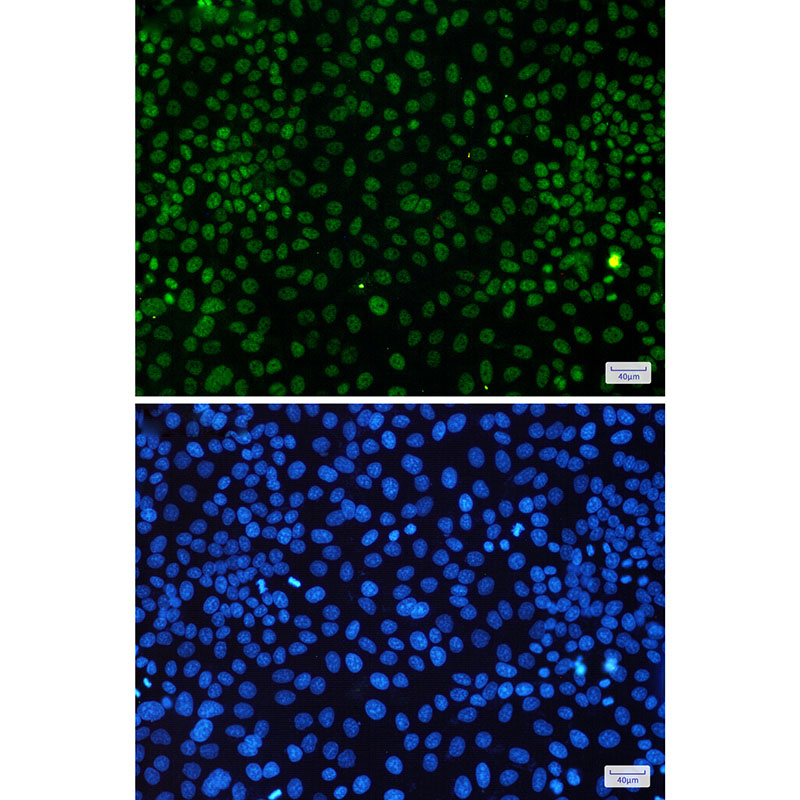 CDK9 Rabbit mAb