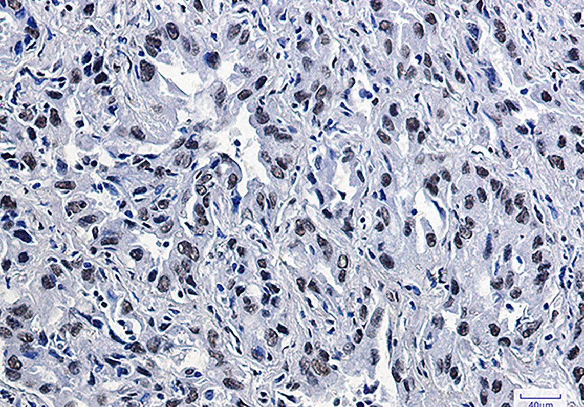 CDK9 Rabbit mAb