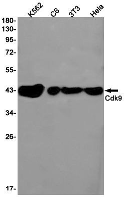 CDK9 Rabbit mAb