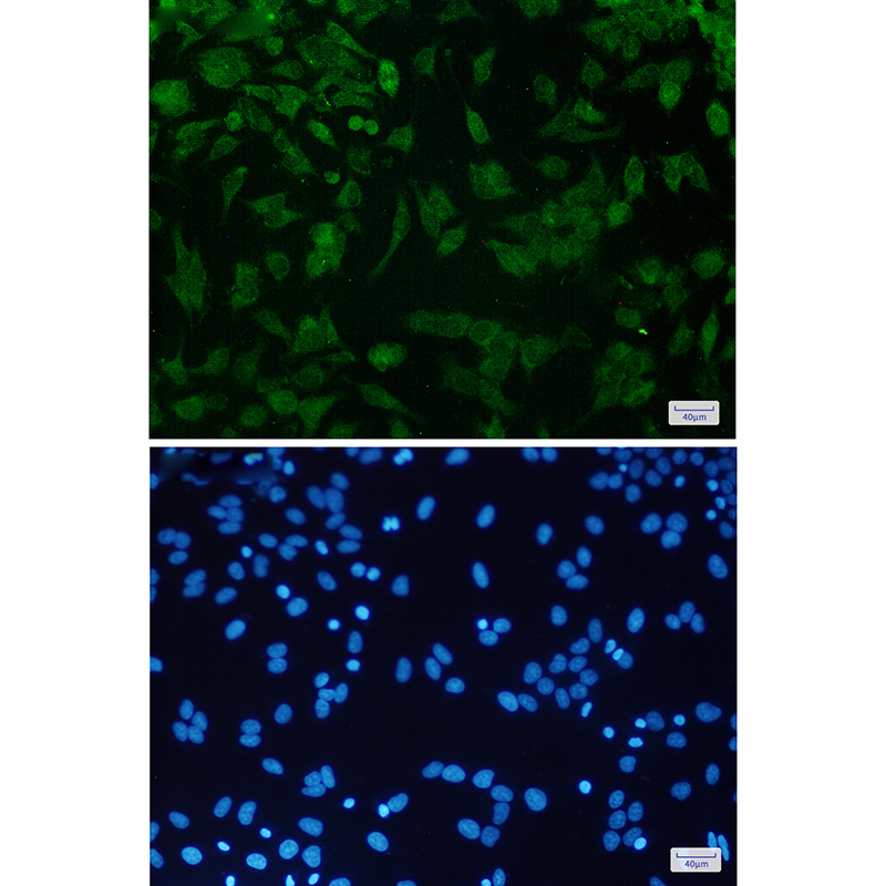 CDKN2A/p16INK4a Rabbit mAb