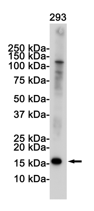 CDKN2A/p16INK4a Rabbit mAb