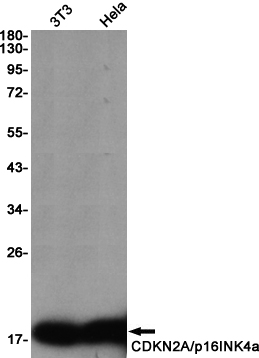 CDKN2A/p16INK4a Rabbit mAb