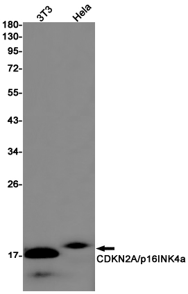 CDKN2A/p16INK4a Rabbit mAb