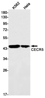 CECR5 Rabbit mAb