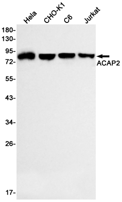 ACAP2 Rabbit mAb