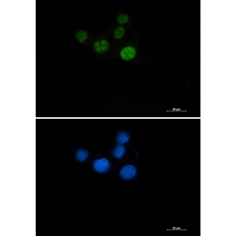 Chk2 Rabbit mAb