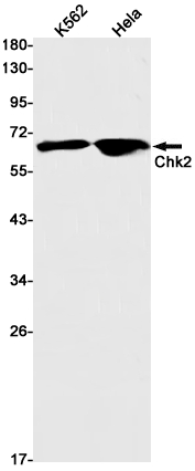 Chk2 Rabbit mAb