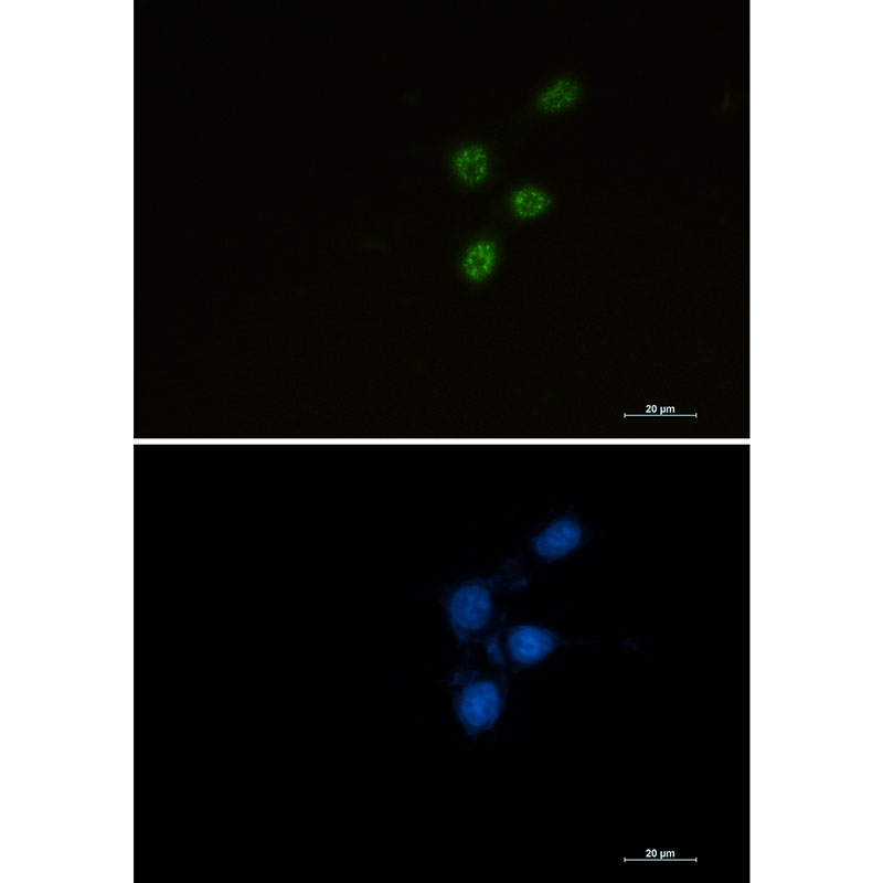 Chk2 Rabbit mAb