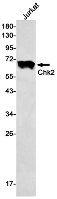 Chk2 Rabbit mAb