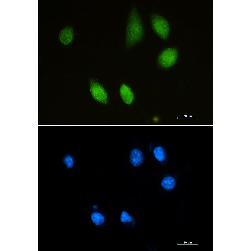 Choline Acetyltransferase Rabbit mAb