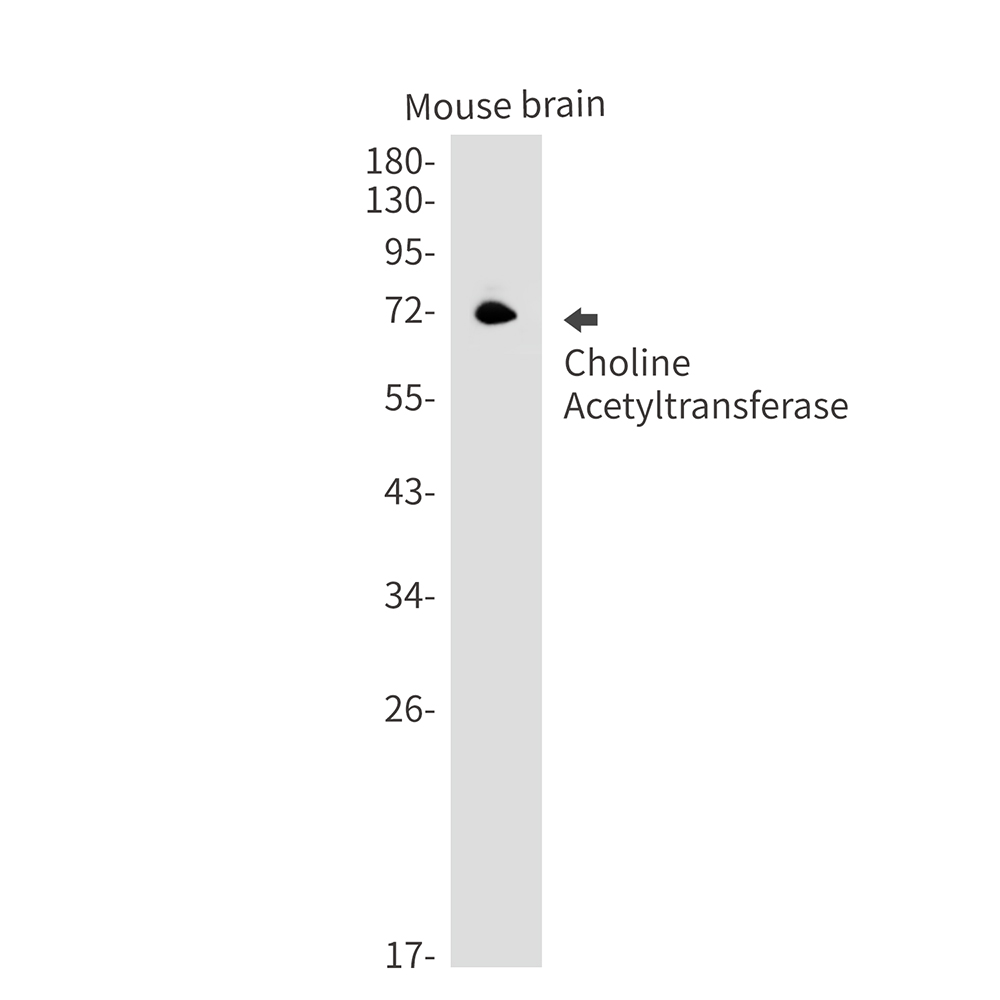 Choline Acetyltransferase Rabbit mAb