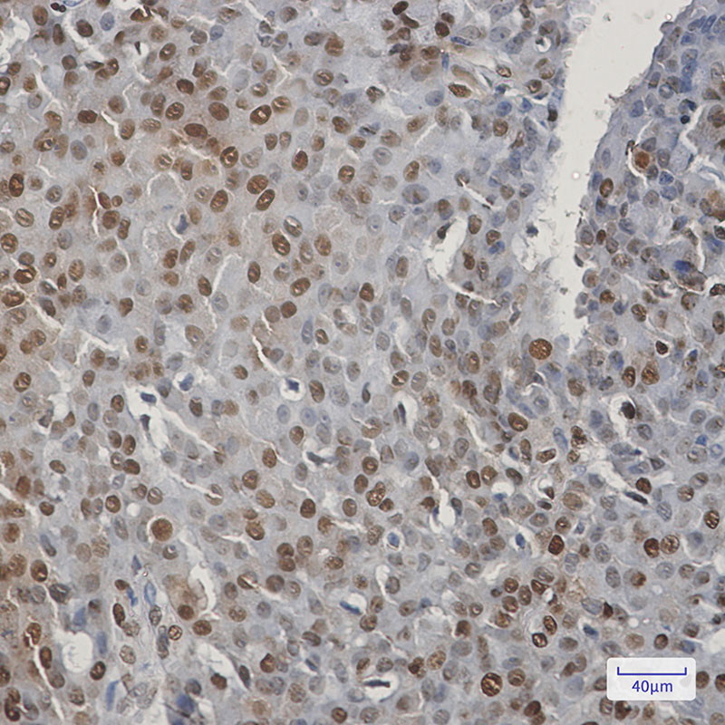 CIRBP Rabbit mAb