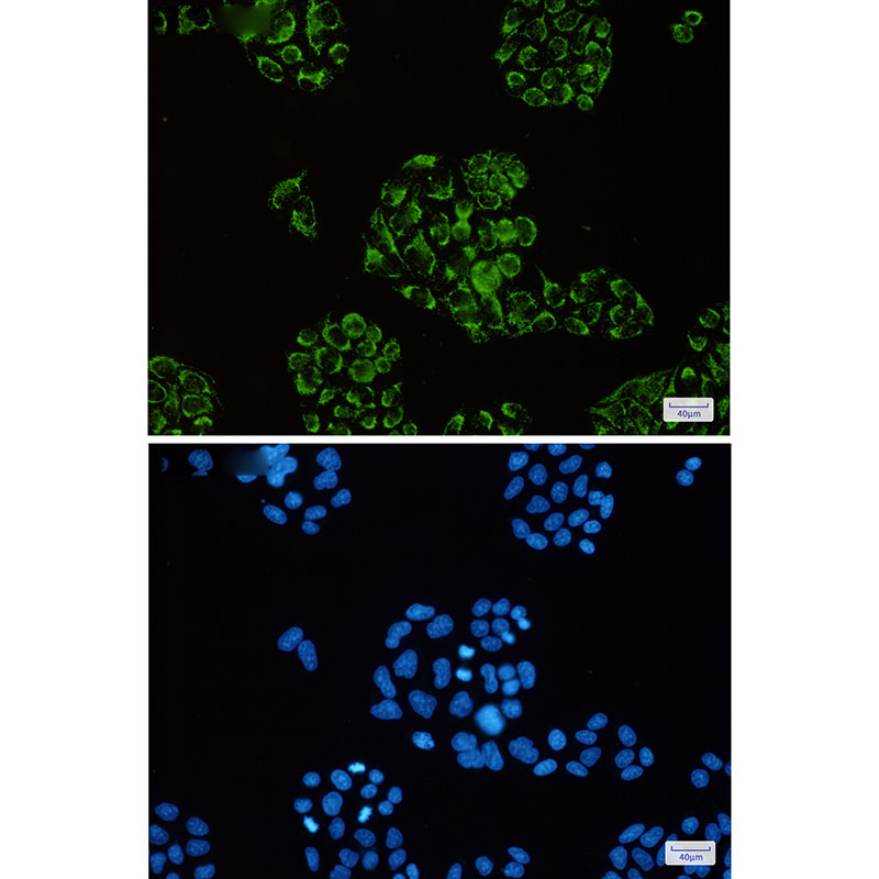 Citrate Synthetase Rabbit mAb