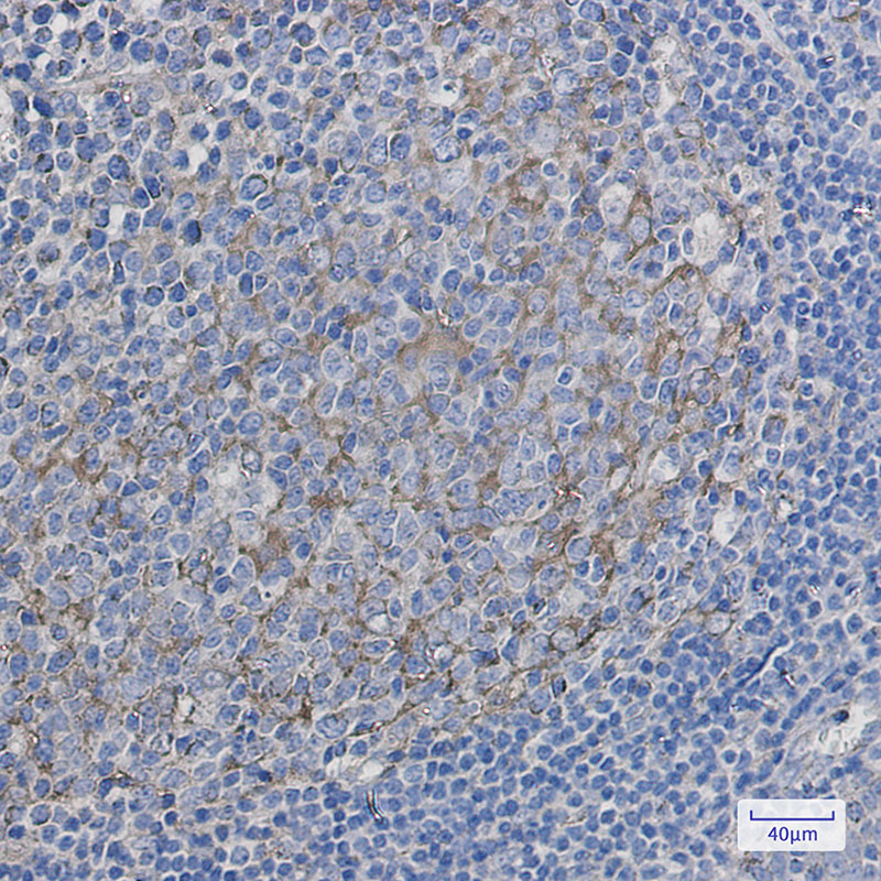 Citrate Synthetase Rabbit mAb