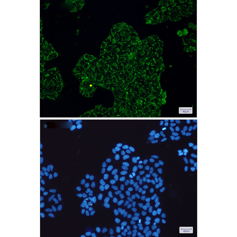 CLIC4 Rabbit mAb