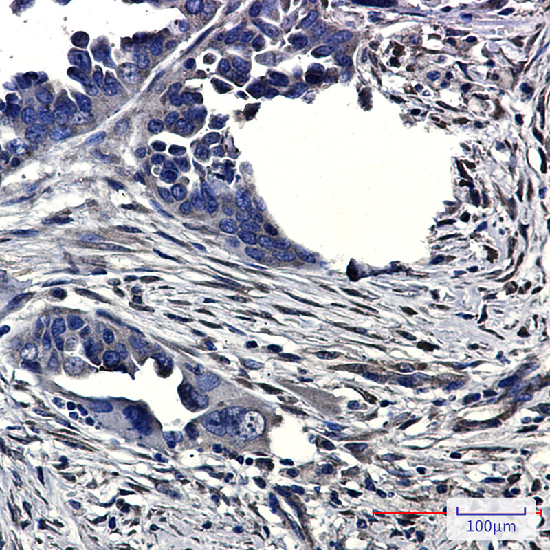 CLIC4 Rabbit mAb