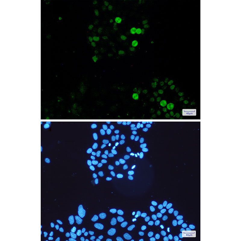 Phospho-c-Myc (Ser62) Rabbit mAb